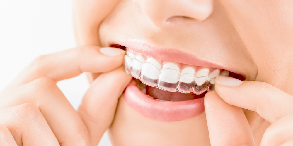 FEATURE02 歯周病になってもできる矯正治療をご提案