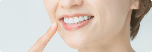 部分矯正（前歯矯正）