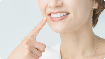 部分矯正（前歯矯正）