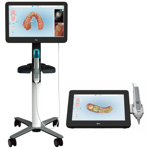 最新の光学スキャナー「iTero」で快適・精密な型取り