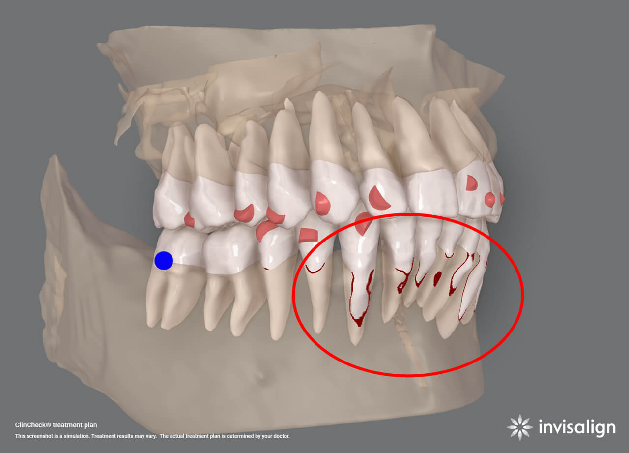 精密検査を基に、適切な治療計画をご提案