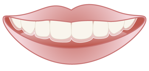 マウスピース矯正（インビザライン）