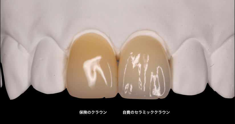 保険診療と自費診療の違い